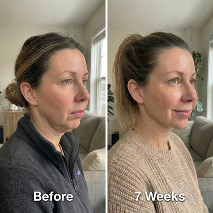 The Sculpting Face Protocol